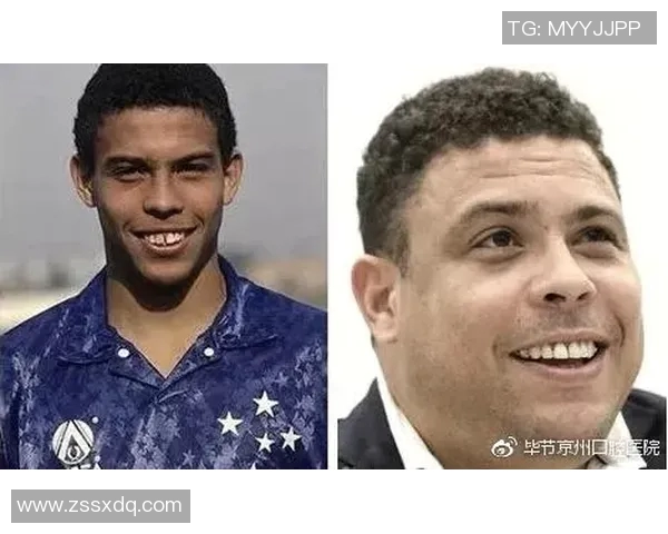 足球明星龅牙特征揭秘哪位球员的笑容最具辨识度